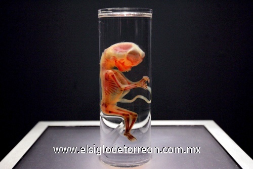 Vista de una de las figuras de la exposición 'Bodies, arte más fascinación'.
La exhibición será inaugurada el próximo 21 de noviembre en el centro de exposiciones Plaza Mayor de Medellín (Colombia). 

La muestra, que ha sido presentada en más de 200 ciudades del mundo, presenta cuerpos y órganos humanos conservados mediante la técnica científica de la plastinación/polimerización
