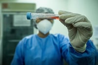 La Secretaría de Salud en Durango instalará en Gómez Palacio un laboratorio de pruebas COVID ante incrementos de casos