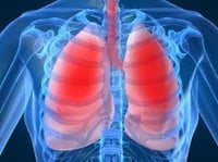 Científicos demuestran la eficacia de una molécula para tratar la fibrosis pulmonar