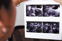 Durango suma cuatro muertes maternas durante 2022