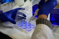 Un estudio cifra en 451 las variantes genéticas vinculadas al cáncer de próstata