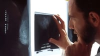 Descubren que la inmunoterapia mejora el tratamiento de cánceres de cérvix