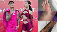 Fuerte pelea entre Alemán y su novia es filtrada; ella muestra huellas de violencia 