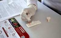 Reforzará IMSS Coahuila acciones para prevenir hepatitis C