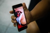 Extracción de un diente, casi le cuesta la vida a un menor de 14 años; padres buscan justicia