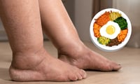¿Qué comer para combatir la retención de líquidos?