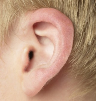 La cirugía conocida como otoplastia, reduce el tamaño de las orejas y consiste en coserlas, literalmente,  a la cabeza,  por medio dos o tres puntos de sutura.