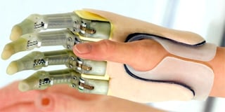 TouchBionics ha presentado en Escocia su último invento, ProDigits, considerados los primeros 'dedos biónicos' del mundo, que se pondrán a la venta por un precio aproximado de 35 mil libras (unos 38 mil 500 euros).