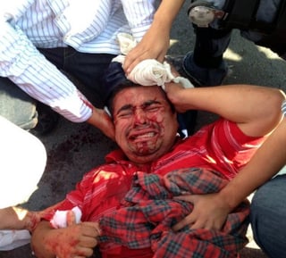 Hombres armados atacaron al reportero Milton Martínez hijo del corresponsal de Televisa México Juan Andrés Martínez en las calles de Mina y Ramos Arizpe en plena Zona Centro de Saltillo.