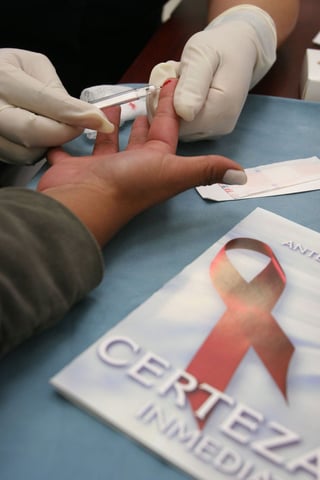 Salud. Procedimiento de la prueba de Elisa para detectar el virus del VIH en la clínica de la Condesa para la detección de enfermos de VIH-Sida.