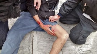 Sangre.Imagen tomada por un estudiante de la herida de su compañero por parte de un policía del DF.