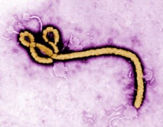 El semen de hombres convalecientes de ébola puede contener el virus hasta tres meses después de desaparecidos los síntomas. (ARCHIVO)