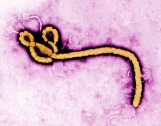 Según los investigadores, esta nueva vacuna puede modificarse para que actúe sobre una cepa específica del virus del ébola y, además, puede ser fabricada en apenas ocho semanas. (ARCHIVO)