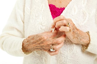 La osteoporosis está muy relacionada con la edad, peso, estatura, dieta baja en calcio, deficiencia de estrógenos por menopausia natural o inducida, así como por la escasa exposición al sol. (ARCHIVO)