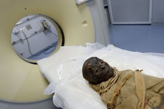 os cadáveres momificados de cientos de personas que padecieron de tuberculosis ayudan a entender mejor la naturaleza de esta enfermedad y han abierto la puerta a nuevas vías de investigación. (ARCHIVO)