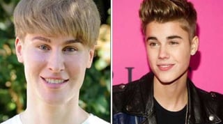 Toby Sheldon gastó 100 mil dólares en cirugías y procesos cosméticos para parecerse a Justin Bieber.(Especial)