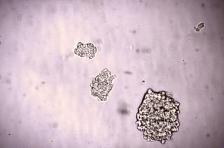 Se espera que las células madre embrionarias, capaces de transformarse en distintos tejidos, alivien los síntomas de la osteogénesis imperfecta, detectada en uno de cada 25,000 recién nacidos. (ARCHIVO)