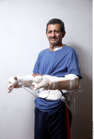 Regreso. A Maximino García Baldazo le tuvieron que amputar los brazos en 2012 debido a una descarga eléctrica que recibió mientras realizaba un trabajo para la CFE en Tamaulipas.