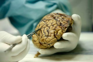 Si se bloquea la inflamación del cerebro, se reducen los problemas de memoria derivados del Alzheimer y se detiene el avance de esta enfermedad neurodegenerativa. (ARCHIVO)