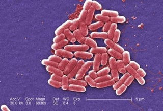 Nuevo enemigo. Estados Unidos ha detectado el primer caso de 'superbacteria' resistente a los antibióticos.