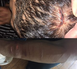 El luchador mexicano fue agredido en un estacionamiento. (Instagram de El Patrón)