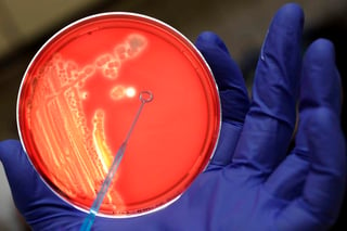 Los investigadores han reconstruido al detalle el proceso de creación de una nueva especie de bacteria en la naturaleza. (ARCHIVO)