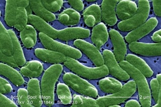 Problema. La resistencia de las bacterias a los antibióticos dificulta el tratamiento de los padecimientos que sí los requieren.