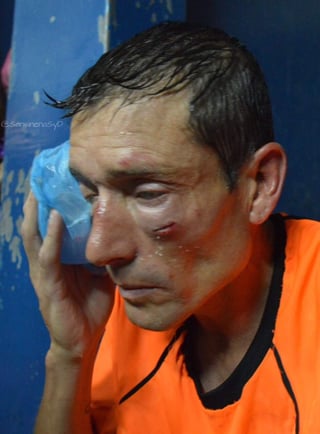 El silbante Claudio Elichiri fue golpeado luego de no marcar un supuesto penal en las inferiores de Argentina. (Especial)