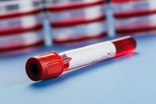Se logró identificar 26 patrones de biomarcadores sanguíneos capaces de predecir la probabilidad de que una persona desarrolle o no algún tipo de enfermedad mortal. (ARCHIVO)