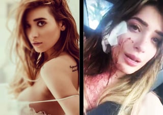 Violencia. Brenda Zambrano fue tendencia en Twitter por un video que circuló en donde reveló que fue golpeada en un antro.