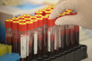 Han desarrollado una tecnología que facilita los procesos de toma, conservación y transporte de las muestras de sangre y hace los análisis más seguros y baratos. (ARCHIVO)