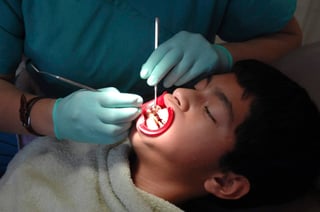 Entre un 70 y 90 % de los escolares en todo el mundo tienen caries dentales. (ARCHIVO)