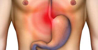 La exposición continua a los ácidos gástricos puede causar daños en la mucosa del sistema digestivo, de manera que las células mutan y desarrollan cáncer cuando la persona no se trata a tiempo. (ESPECIAL)