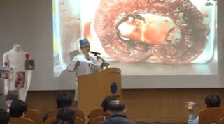 “Llevo más de 20 años como cirujano y no he hallado parásitos de este tamaño en los intestinos de los surcoreanos”, dijo Lee Cook-jong, quien dirige al equipo médico que atiende al soldado, a los reporteros. (ESPECIAL)