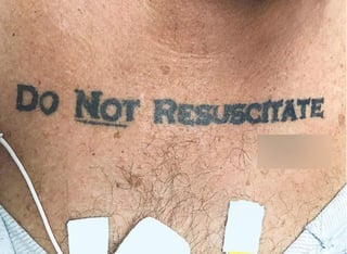 Se decidió que el tatuaje era una forma de ‘voluntad final’ del paciente. (INTERNET)