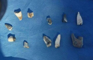 Encontraron cerca de 3 mil fragmentos óseos únicamente en la superficie así como piezas dentales. (EL SIGLO DE TORREÓN) 