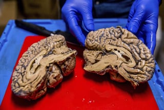 Los expertos concluyeron que el cerebro mostró cuatro tipos diferentes de actividad neuronal. (ARCHIVO)