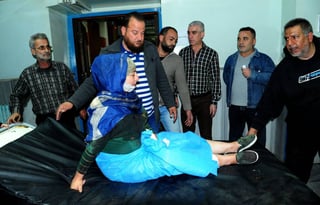 Sin piedad. Una mujer herida recibió atención en un hospital de Jaramana, Siria. (EFE)