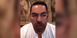 Jorge D'Alessio narró a través de un video en Instagram el asalto del que fue víctima. (ESPECIAL)