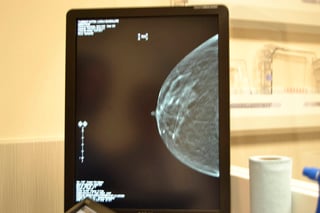 Revisión. El estudio consiste en obtener una imagen de los tejidos y glándulas de las mamas por medio del mastógrafo. (EL SIGLO DE TORREÓN)