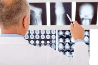 El IMSS informo que las principales causas de que ocurra la osteoporosis es por el sobrepeso, mala alimentación y poca actividad física. (ARCHIVO)