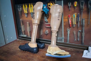 Ingenieros del MIT lograron desarrollar un pie protésico a muy bajo costo para que se adapte al peso y tamaño del cuerpo. (ARCHIVO)
