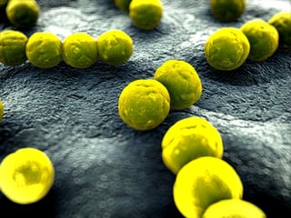 Investigadores dieron a conocer un nuevo estudio en el que advierten que un implante corporal es hábitat para bacterias y hongos. (ARCHIVO)
