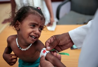 Cifra. Informe de 'Save the Children' reveló que 85 mil niños menores de 5 años han muerto en Yemen en cuatro años. (AP)
