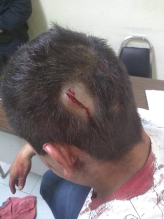 Lesión. El joven resultó con una herida en la cabeza y en la mano izquierda.