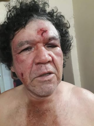 El obrero simpatizante de Gómez Urrutia acusó al hijo de un dirigente del opositor Sindicato Democrático del ataque. (EL SIGLO COAHUILA) 