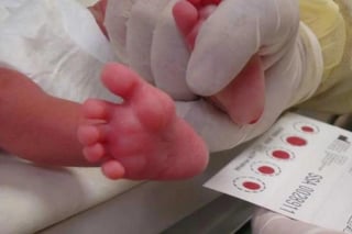 La Secretaría de Salud en el estado de Durango, no ha suspendido la toma de tamiz neonatal; mantiene en resguardo las pruebas. (EL SIGLO DE TORREÓN)