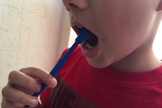 En la región Laguna Durango, 7 de cada 10 niños presenta caries en por lo menos 3 de sus piezas dentales. (EL SIGLO DE TORREÓN)