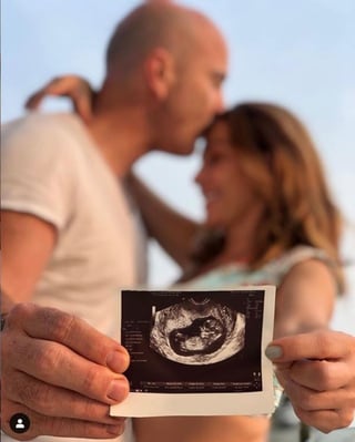 Emocionados. Érika Zaba, de OV7, compartió con sus seguidores el ultrasonido de su bebé; tiene tres meses de embarazo.
