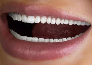 La gente que hay demasiados dientes para que sea normal. (INTERNET)